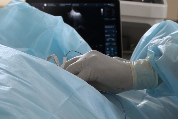 Рязанские врачи сохранили почку пациента, повторно удалив опухоль